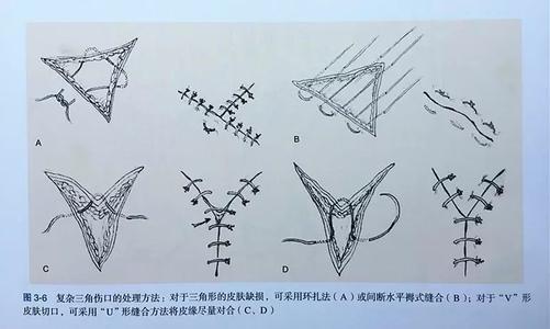 怎么画伤口伤口简笔画教程
